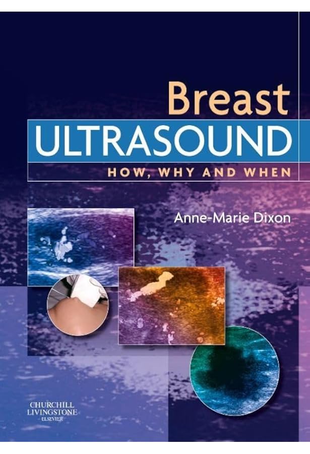Breast Ultrasound: 9780397516247: Medicine & Health Science Books